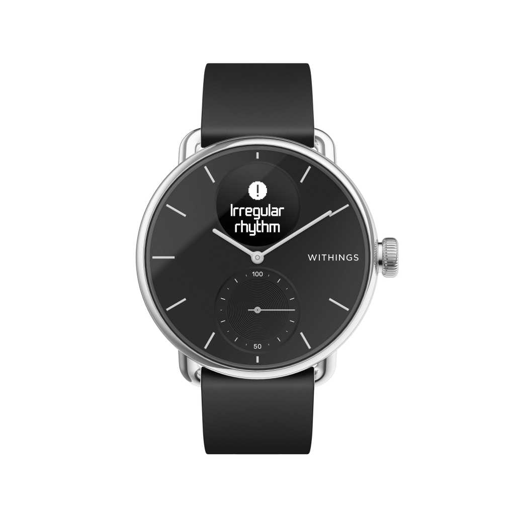 scanwatch